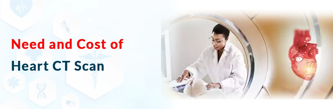 Need and Cost of Heart CT scan